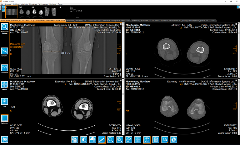 Przeglądarka DICOM - IQ VIEW PRO (licencja roczna)